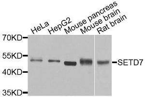 Western blot analysis of extracts of various cell lines, using SETD7 antibody. (SETD7 抗体  (AA 1-366))