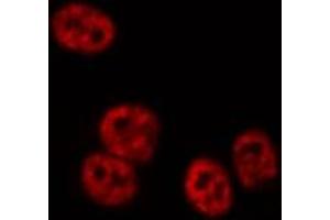 ABIN6269226 staining PC-3 cells by IF/ICC. (DDIT3 抗体  (N-Term))
