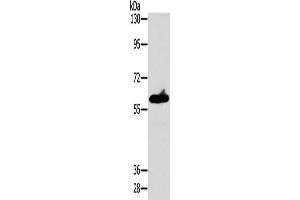 Gel: 8 % SDS-PAGE, Lysate: 40 μg, Lane: A549 cells, Primary antibody: ABIN7128549(ASB3 Antibody) at dilution 1/200, Secondary antibody: Goat anti rabbit IgG at 1/8000 dilution, Exposure time: 10 seconds