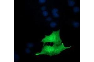 Image no. 4 for anti-NFKB Inhibitor Interacting Ras-Like 1 (NKIRAS1) antibody (ABIN1499742)