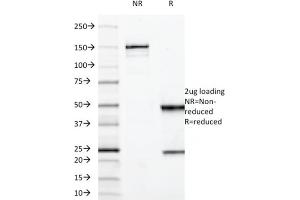 SDS-PAGE Analysis Purified MUC3 Mouse Monoclonal Antibody (M3. (MUC3A 抗体)