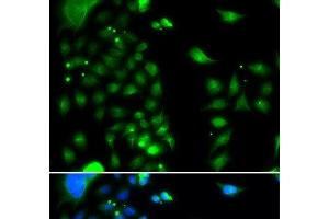 Immunofluorescence analysis of MCF-7 cells using UBE2J2 Polyclonal Antibody (UBE2J2 抗体)