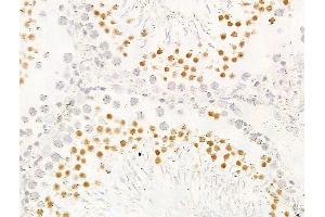 ABIN7094792 and ABIN7098843 at 1/100 staining Rat testis tissue by IHC-P.