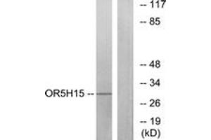 Western blot analysis of extracts from COLO cells, using OR5H15 Antibody. (OR5H15 抗体  (AA 241-290))