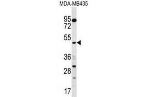 Western Blotting (WB) image for anti-Sorting Nexin 4 (SNX4) antibody (ABIN2996990) (Sorting Nexin 4 抗体)