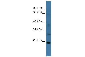 Western Blot showing STARD4 antibody used at a concentration of 1-2 ug/ml to detect its target protein. (STARD4 抗体  (Middle Region))