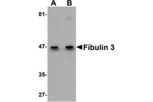 Western Blotting (WB) image for anti-Fibulin 3 (FBLN3) (C-Term) antibody (ABIN1030395) (FBLN3 抗体  (C-Term))