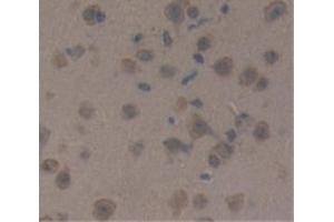 IHC-P analysis of Mouse Tissue, with DAB staining. (CRH 抗体  (AA 28-160))
