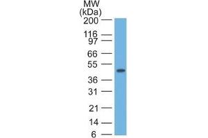 Western blot of HeLa lysate using CK17 Monoclonal Antibody (SPM560). (KRT17 抗体)