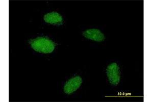 Immunofluorescence of purified MaxPab antibody to POGZ on HeLa cell. (POGZ 抗体  (AA 1-1357))