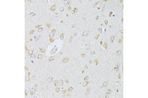 Immunohistochemistry of paraffin-embedded rat brain using NTS antibody (ABIN5998396) at dilution of 1/100 (40x lens). (Neurotensin 抗体)