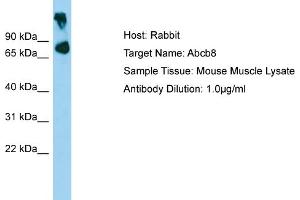 WB Suggested Anti-Abcb8 Antibody   Titration: 1. (ABCB8 抗体  (Middle Region))