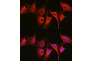 Immunofluorescence analysis of C6 cells using HSP70/HSP Rabbit pAb  at dilution of 1:250 (40x lens). (HSP70 1A 抗体  (C-Term))