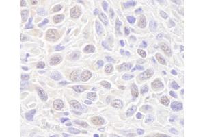 Immunohistochemistry (IHC) image for anti-RAD50 Homolog (S. Cerevisiae) (RAD50) (AA 700-750) antibody (ABIN7448751)