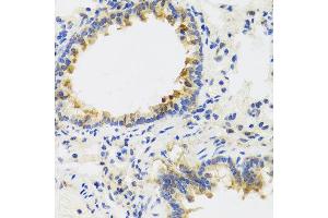 Immunohistochemistry of paraffin-embedded rat lung using UVRAG antibody at dilution of 1:100 (x40 lens). (UVRAG 抗体)