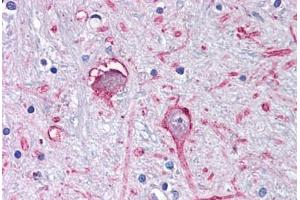 Anti-GABRA3 antibody  ABIN1048638 IHC staining of human brain, globus pallidus. (GABRA3 抗体  (C-Term))