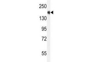 SRC-1 antibody western blot analysis in CEM lysate. (NCOA1 抗体  (AA 1338-1367))