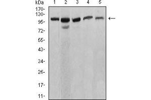 Western blot analysis using ATP2A1 mouse mAb against C2C12 (1), COS7 (2), Hela (3), K562 (4), and Jurkat (5) cell lysate. (ATP2A1/SERCA1 抗体  (AA 487-631))