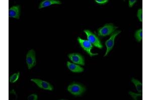 Immunofluorescence staining of A549 cells with ABIN7172853 at 1:100, counter-stained with DAPI. (TRPM1 抗体  (AA 1-97))