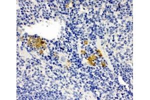 IHC-P: Leupaxin antibody testing of mouse spleen tissue (Leupaxin 抗体  (N-Term))