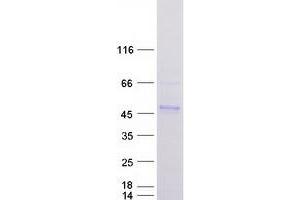 Validation with Western Blot