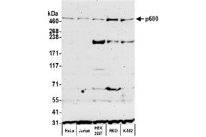 Western Blotting (WB) image for anti-Ubiquitin Protein Ligase E3 Component N-Recognin 4 (UBR4) (AA 1350-1400) antibody (ABIN7454815)