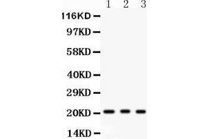Anti- MGMT Picoband antibody, Western blotting All lanes: Anti MGMT  at 0. (MGMT 抗体  (AA 2-207))