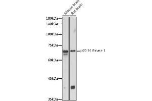 Western blot analysis of extracts of various cell lines, using p70 S6 Kinase 1 1 antibody (ABIN7270029) at 1:1000 dilution. (RPS6KB1 抗体  (AA 361-525))