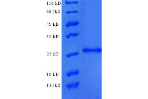 SDS-PAGE (SDS) image for Protein C Receptor, Endothelial (PROCR) (AA 18-210), (partial) protein (His tag) (ABIN5712468)