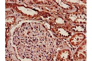 Immunohistochemistry (IHC) image for anti-14-3-3 alpha + beta (YWHAB) (AA 1-246) antibody (ABIN7142083)