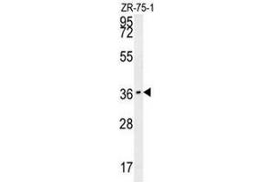 CLEC12A Antibody (Center) western blot analysis in ZR-75-1 cell line lysates (35µg/lane). (CLEC12A 抗体  (Middle Region))