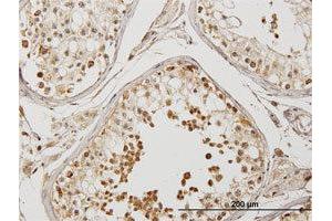 Immunoperoxidase of purified MaxPab antibody to DYX1C1 on formalin-fixed paraffin-embedded human testis. (DYX1C1 抗体  (AA 1-381))