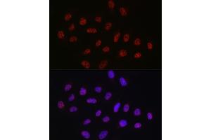 Immunofluorescence analysis of U2OS cells using DDX39A antibody (ABIN6131590, ABIN6139489, ABIN6139491 and ABIN6223963) at dilution of 1:50.