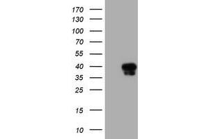 Western Blotting (WB) image for anti-serpin Peptidase Inhibitor, Clade A (Alpha-1 Antiproteinase, Antitrypsin), Member 5 (SERPINA5) antibody (ABIN1500056) (SERPINA5 抗体)