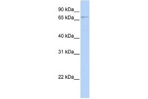 WB Suggested Anti-GLMN Antibody Titration: 0.