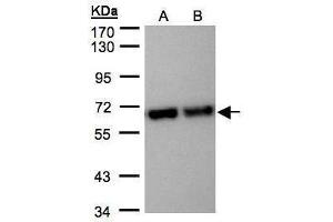 WB Image Sample(30 μg of whole cell lysate) A:Hep G2, B:MOLT4, 7. (STIP1 抗体)