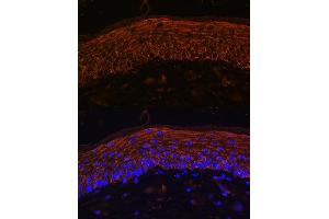 Immunofluorescence analysis of Mouse skin using  Rabbit pAb (ABIN6134303, ABIN6136434, ABIN6136435 and ABIN6216449) at dilution of 1:100. (CXCR7 抗体  (AA 50-150))