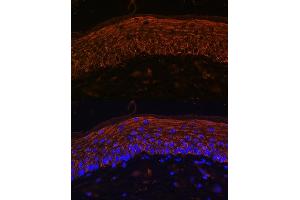 Immunofluorescence analysis of Mouse skin using  Rabbit pAb (ABIN6134303, ABIN6136434, ABIN6136435 and ABIN6216449) at dilution of 1:100.