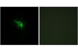 Immunofluorescence analysis of A549 cells, using TPIP1 Antibody. (TP53AIP1 抗体  (AA 75-124))