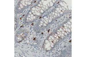 Immunohistochemical staining (Formalin-fixed paraffin-embedded sections) of human colon with KIT monoclonal antibody, clone CL1667  shows strong immunoreactivity in some lymphoid cells.