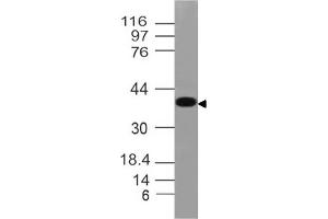 Image no. 1 for anti-N-Myc Downstream Regulated 1 (NDRG1) (AA 123-318) antibody (ABIN5027495) (NDRG1 抗体  (AA 123-318))