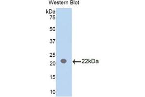Western blot analysis of the recombinant protein. (IL18BP 抗体  (AA 29-193))