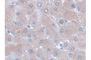 Immunohistochemistry (IHC) image for anti-Glutamic-Oxaloacetic Transaminase 1, Soluble (Aspartate Aminotransferase 1) (GOT1) (AA 1-413) antibody (ABIN7426220)