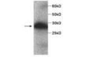 Image no. 1 for anti-serpin Peptidase Inhibitor, Clade B (Ovalbumin), Member 4 (SERPINB4) antibody (ABIN791515) (SERPINB4 抗体)