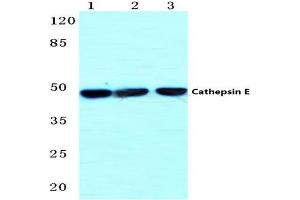 Western blot (WB) analysis of Cathepsin E antibody  at 1/500 dilution. (Cathepsin E 抗体)