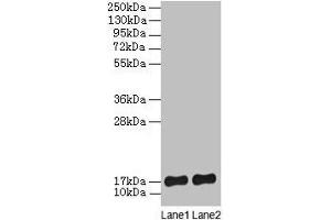 Western blot All lanes: SRP19 antibody at 2 μg/mL Lane 1: Jurkat whole cell lysate Lane 2: Hela whole cell lysate Secondary Goat polyclonal to rabbit lgG at 1/15000 dilution Predicted band size: 17, 13, 9 kDa Observed band size: 17 kDa (SRP19 抗体  (AA 2-144))