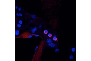 Mouse cochlea immunofluorescence.