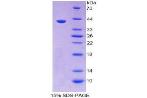 SDS-PAGE (SDS) image for Secretoglobin, Family 3A, Member 1 (SCGB3A1) (AA 21-104) protein (His tag,GST tag) (ABIN2123584)