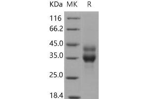 Western Blotting (WB) image for Cathepsin B (CTSB) (Active) protein (His tag) (ABIN7194669)