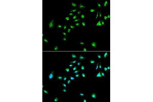 Immunofluorescence analysis of A549 cell using RAF1 antibody. (RAF1 抗体  (AA 190-350))